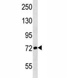 ATG7 Antibody (APG7)