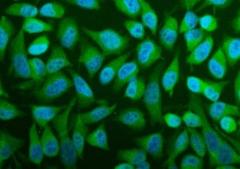 PFAS Antibody / Phosphoribosylformylglycinamidine synthase