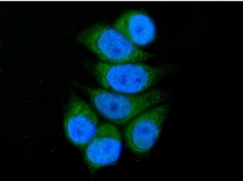 ACADSB Antibody / SBCAD