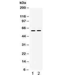 Western blot testing of human 1) K562 and 2) Jurkat cell lysate with MMP-8 antibody. Expected molecu