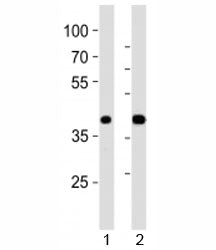 Western blot analysis of lysate from 1) mouse pancreas and 2) rat pancreas tissue using PDX1 antibod