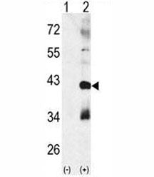 MAPK11 Antibody