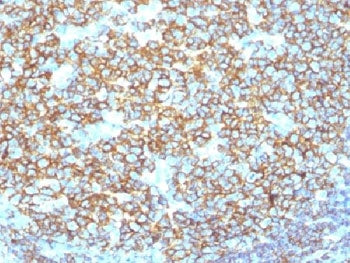 IHC testing of recombinant CD20 antibody and FFPE human tonsil tissue. Required HIER: steam section 