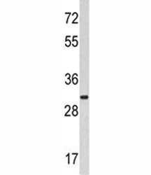 MARCKS Antibody