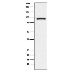 Topoisomerase I Antibody / TOP1