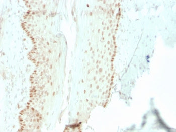 IHC staining of FFPE human cervix with recombinant SOX2 antibody (clone rSOX2/1792). HIER: boil tiss