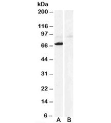 Western blot testing of human heart lysate with Monoamine Oxidase A antibody at 0.3ug/ml with [B] an