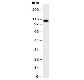 CSF1R Antibody / Colony Stimulating Factor 1 Receptor