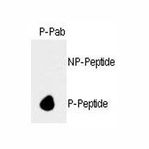 Retinoblastoma / Rb Antibody (phospho-S788)