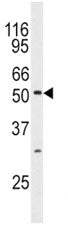 JNK3 Antibody