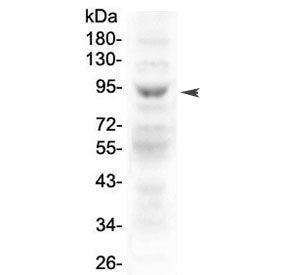 Western blot testing of mouse thymus lysate with MAP3K20 antibody at 0.5ug/ml. Predicted molecular w