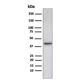 Western blot analysis of human A431 cell lysate using recombinant Filaggrin antibody (clone FLG/3909