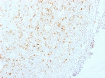 Aurora B Antibody / AURKB