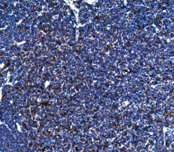 IHC staining of FFPE rat lymph node tissue with Blr1 antibody. HIER: boil tissue sections in pH8 EDT