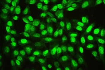 Ran Antibody