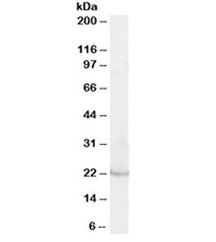 Western blot testing of human kidney lysate with Lipocalin 2 antibody at 0.03ug/ml. Predicted molecu