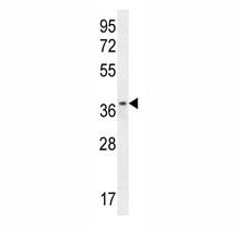 ZNF322B Antibody