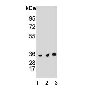 Thymidylate Synthase Antibody