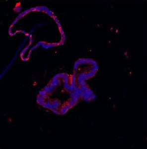 Immunofluorescent staining of FFPE human colon with Lysozyme antibody (red) and DAPI (blue). HIER: B