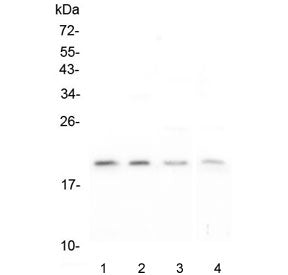 Western blot testing of human 1) T-47D, 2) HEK293, 3) K562 and 4) Caco-2 lysate with APRT antibody a
