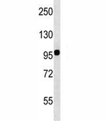 Integrin beta 7 Antibody (ITGB7)