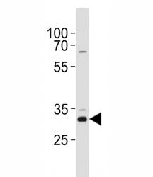 Cyclin D1 Antibody (CCND1)