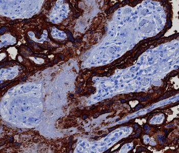 Placental Alkaline Phosphatase Antibody / ALPP