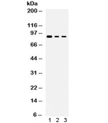 Western blot testing of human 1) MCF7, 2) COLO-320 and 3) PANC-1 lysate with ATXN1 antibody. Commonl