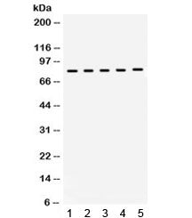 Western blot testing of 1) rat brain, 2) rat testis, 3) mouse brain, 4) mouse testis, 5) human MCF7 