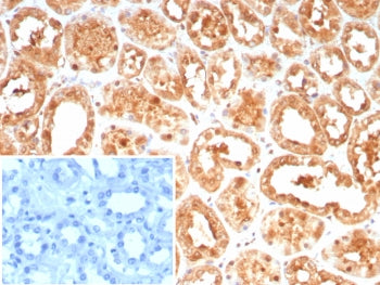 IHC staining of FFPE human kidney tissue with HSPA1A antibody (clone HSPA1A/7936). Inset: PBS used i