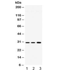 Western blot testing of 1) rat brain, 2) mouse brain and 3) human HeLa lysate with AQP11 antibody at