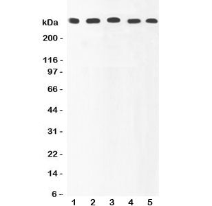 Western blot testing of Ki67 antibody and human samples 1: HeLa; 2: MCF-7; 3: COLO320; 4: HEPG2; 5: 