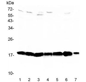 Western blot testing of 1) rat testis, 2) rat brain, 3) rat thymus, 4) mouse testis, 5) mouse brain,