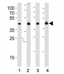 IDH1 Antibody