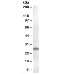 CLEC1B Antibody
