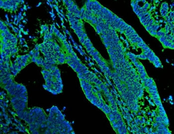 N-Cadherin Antibody