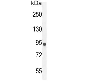 IL-2 Receptor Antibody beta 2 subunit / IL2RB2