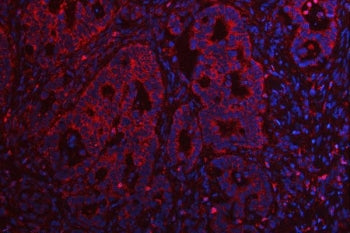 TMEM132B Antibody / Transmembrane protein 132B