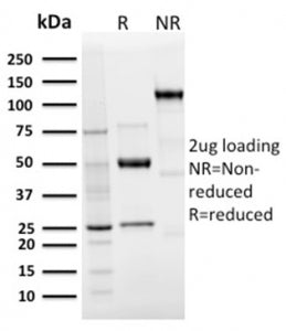SDS-PAGE analysis of purified, BSA-free recombinant Langerin antibody (LGRN/3136R) as confirmation o
