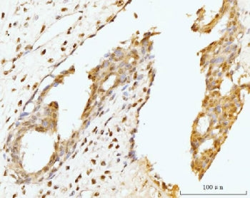 GNL3 Antibody / Nucleostemin