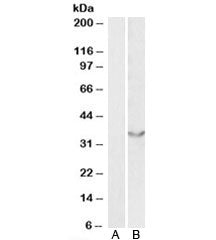 Western blot testing of human heart lysate with JAM2 antibody at 0.5ug/ml with [B] and without [A] b
