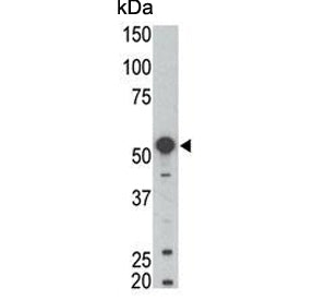 BLK Antibody / B lymphocyte kinase