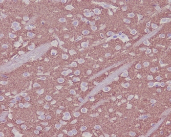 Synaptophysin Antibody