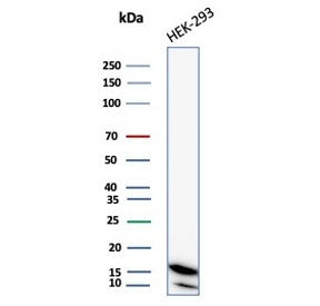 Western blot testing of human MCF-7 cell lysate with NDKB antibody (clone NME2/6437). Predicted mole