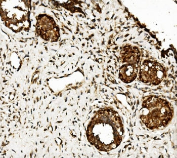 CLPB Antibody