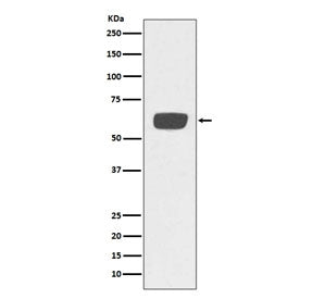 tPA Antibody / Tissue Plasminogen Activator