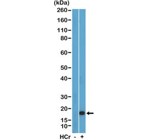 H3K27cr Antibody / Crotonylated-Histone H3 Lysine 27