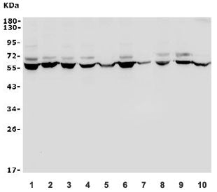 WNT2B Antibody