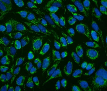 LRPPRC Antibody / GP130