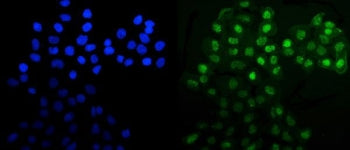MNAT1 Antibody